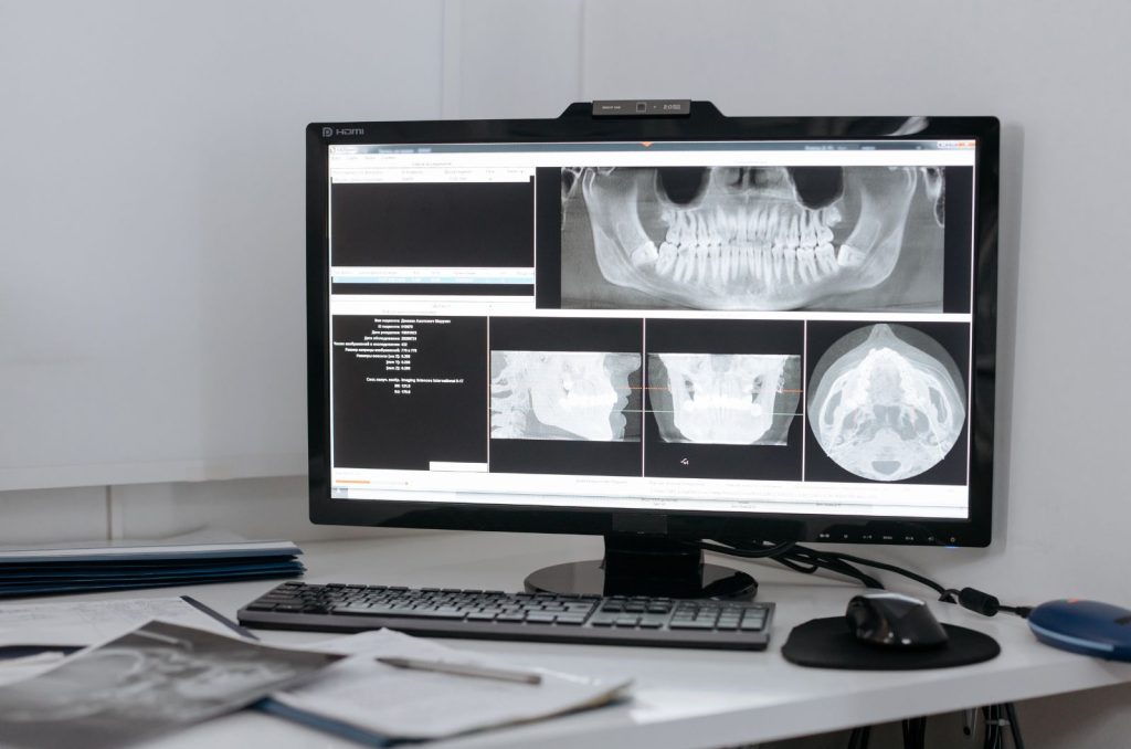 Dental Precision Imaging
