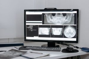 Dental Precision Imaging