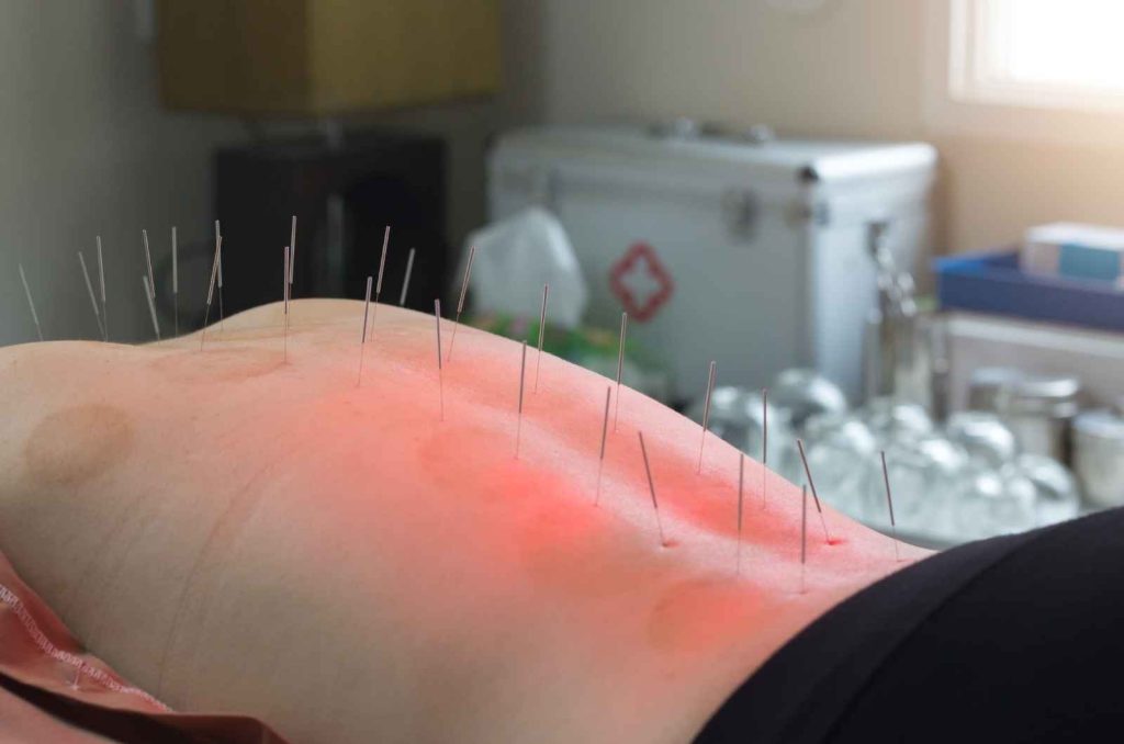 רפואה סינית