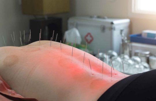 רפואה סינית2